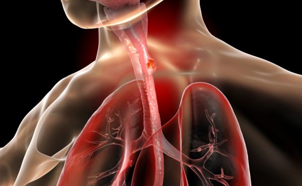 Conferencia: Diagnóstico y tratamiento de la Disfagia: una mirada integral