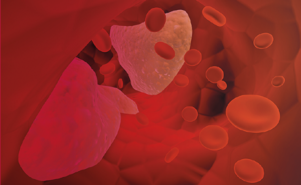 Diplomatura: Aterosclerosis y Cardiometabolismo