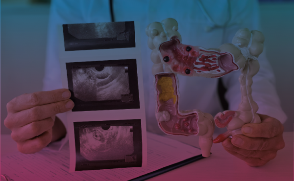 La cadena visceral ¿influye en la visión y en la oclusión?