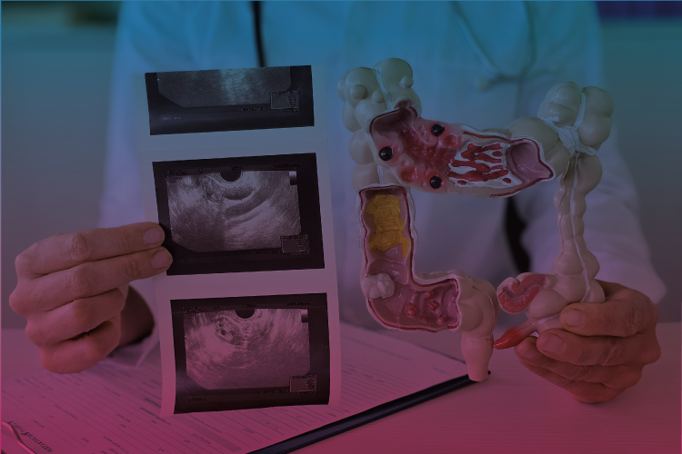 La cadena visceral ¿influye en la visión y en la oclusión?